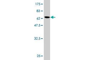 Western Blot detection against Immunogen (61.