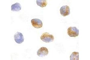 Immunocytochemistry of CARD9 in K562 cells with AP30185PU-N CARD9 antibody at 10 μg/ml. (CARD9 抗体)