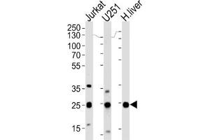 Western Blotting (WB) image for anti-Glutathione S-Transferase mu 1 (GSTM1) antibody (ABIN3002864) (GSTM1 抗体)