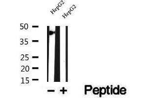 Western blot analysis of extracts of HepG2 cells, using SMYD3 antibody. (SMYD3 抗体  (N-Term))