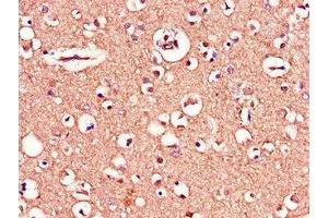 Immunohistochemistry of paraffin-embedded human brain tissue using ABIN7159770 at dilution of 1:100 (MAPT 抗体  (AA 33-166))