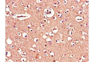 Immunohistochemistry of paraffin-embedded human brain tissue using ABIN7159770 at dilution of 1:100 (MAPT 抗体  (AA 33-166))