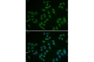 Immunofluorescence (IF) image for anti-Tumor Protein P63 (TP63) (AA 421-680) antibody (ABIN6219346) (p63 抗体  (AA 421-680))