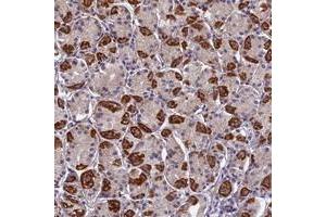 Immunohistochemical staining of human stomach with PLAC9 polyclonal antibody  shows strong cytoplasmic positivity in parietal cells at 1:500-1:1000 dilution. (PLAC9 抗体)