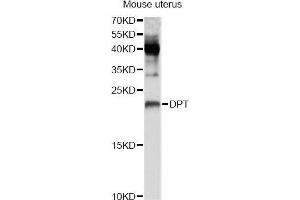 Western blot analysis of extracts of mouse uterus, using DPT Antibody (ABIN5995761) at 1/1000 dilution. (Dermatopontin 抗体)