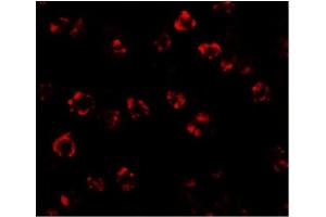 Immunofluorescence of SPT2 in 3T3 cells with SPT2 Antibody at 20 µg/ml. (SPTLC2 抗体  (C-Term))