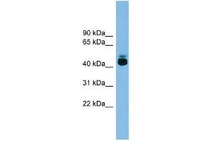 GPR87 antibody used at 1 ug/ml to detect target protein. (GPR87 抗体  (Middle Region))