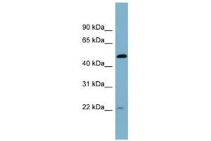 UCHL5IP antibody used at 1 ug/ml to detect target protein. (HAUS7 抗体  (Middle Region))