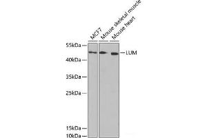 Western blot analysis of extracts of various cell lines using LUM Polyclonal Antibody at dilution of 1:1000. (LUM 抗体)