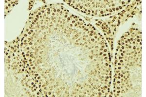 ABIN6276701 at 1/100 staining Mouse testis tissue by IHC-P. (IGF2BP1 抗体  (N-Term))