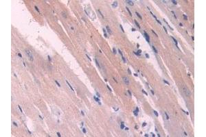 Immunohistochemistry (IHC) image for anti-Nitric Oxide Synthase Trafficker (NOSTRIN) (AA 1-245) antibody (ABIN7432256)