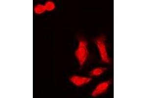 Immunofluorescent analysis of HCCR-1 staining in MCF7 cells. (LETMD1 抗体)