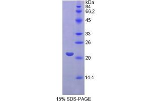 SDS-PAGE analysis of Human FGF13 Protein. (FGF13 蛋白)