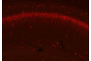 Adult WT and KO mouse hippocampus immunofluorescence with N206A/8 (green) and KC rabbit anti- Kv2. (GFAP 抗体  (AA 411-422))
