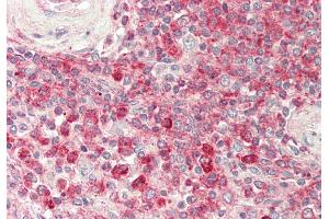 Rabbit Anti-PTDSS1 antibody  Formalin Fixed Paraffin Embedded Tissue: Human Spleen Primary antibody Concentration: 1:100 Secondary Antibody: Donkey anti-Rabbit-Cy3 Secondary Antibody Concentration: 1:200 Magnification: 20x Exposure Time: 0. (PTDSS1 抗体  (N-Term))