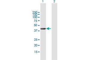 Western Blot analysis of SETMAR expression in transfected 293T cell line by SETMAR MaxPab polyclonal antibody. (SETMAR 抗体  (AA 1-352))