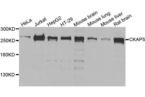 CKAP5 抗体  (AA 1763-2032)