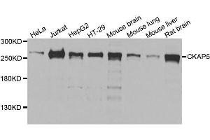 Western blot analysis of extracts of various cell lines, using CKAP5 antibody. (CKAP5 抗体  (AA 1763-2032))