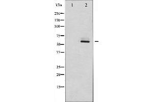 Western blot analysis of Fyn expression in 293 whole cell lysates,The lane on the left is treated with the antigen-specific peptide.