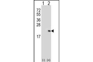 Western blot analysis of RFK (arrow) using rabbit polyclonal RFK Antibody (C15) (ABIN391271 and ABIN2841321). (Riboflavin Kinase 抗体  (N-Term))