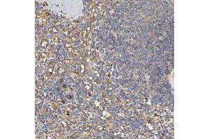 IHC analysis of TXNDC5 using anti-TXNDC5 antibody (ABIN7599699).