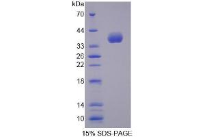 SDS-PAGE analysis of Mouse ALOX12B Protein. (ALOX12B 蛋白)
