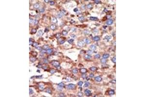 Image no. 2 for anti-YY1 Transcription Factor (YY1) (Middle Region) antibody (ABIN357757) (YY1 抗体  (Middle Region))