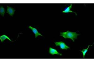Immunofluorescence staining of SY5Y Cells with ABIN7127838 at 1:50, counter-stained with DAPI. (Recombinant TPT1 抗体)