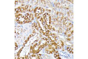 Immunohistochemistry (IHC) image for anti-Chloride Channel, Nucleotide-Sensitive, 1A (CLNS1A) (AA 1-237) antibody (ABIN7266334)