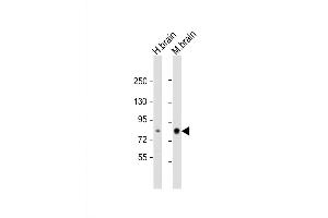 Western Blot at 1:2000 dilution Lane 1: human brain lysate Lane 2: mouse brain lysate Lysates/proteins at 20 ug per lane. (PKC beta1/2 (AA 303-334) 抗体)