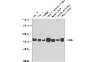 Western blot analysis of extracts of various cell lines using GPD2 Polyclonal Antibody at dilution of 1:1000. (GPD2 抗体)
