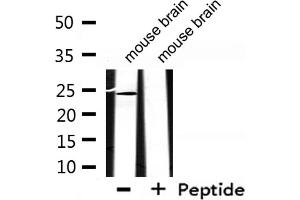 Western blot analysis of extracts from mouse brain, using EFNA2 Antibody. (Ephrin A2 抗体  (N-Term))