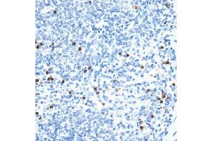 Immunohistochemistry (IHC) image for anti-Matrix Metallopeptidase 9 (Gelatinase B, 92kDa Gelatinase, 92kDa Type IV Collagenase) (MMP9) (AA 538-707) antibody (ABIN6143920)