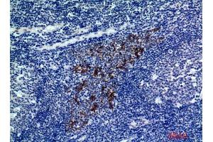 Immunohistochemistry (IHC) analysis of paraffin-embedded Human Tonsils, antibody was diluted at 1:200. (CMTM8 抗体)