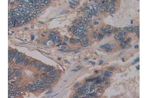 Immunohistochemistry (IHC) image for anti-Basigin (Ok Blood Group) (BSG) (AA 79-280) antibody (ABIN7433759)