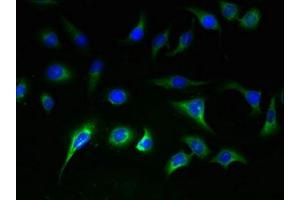 Immunofluorescent analysis of A549 cells using ABIN7170191 at dilution of 1:100 and Alexa Fluor 488-congugated AffiniPure Goat Anti-Rabbit IgG(H+L) (SLC25A36 抗体  (AA 58-110))