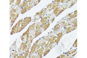 Immunohistochemistry of paraffin-embedded Mouse heart using CASQ2 Polyclonal Antibody at dilution of 1:100 (40x lens). (CASQ2 抗体)