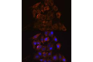 Immunofluorescence analysis of C6 cells using UPF1/RENT1 Rabbit mAb (ABIN7271226) at dilution of 1:100 (40x lens). (RENT1/UPF1 抗体)