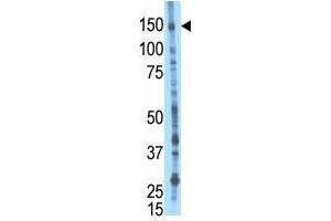 Image no. 1 for anti-BMP2 Inducible Kinase (BMP2K) (Middle Region) antibody (ABIN357190) (BMP2K 抗体  (Middle Region))