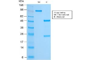 SDS-PAGE Analysis Purified FOXA1 Rabbit Recombinant Monoclonal Antibody (FOXA1/2230R). (Recombinant FOXA1 抗体  (AA 372-472))
