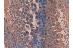DAB staining on IHC-P; Samples: Mouse Testis Tissue (BLMH 抗体  (AA 27-164))