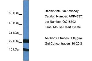 Western Blotting (WB) image for anti-Frataxin (FXN) (Middle Region) antibody (ABIN2783174) (Frataxin 抗体  (Middle Region))