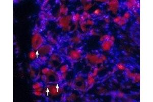 Expression of TrkA in rat DRG - Immunohistochemical staining of rat dorsal root ganglia (DRG) frozen sections using Anti-TrkA (extracellular) Antibody (ABIN7043385, ABIN7044771 and ABIN7044772), (1:100). (TRKA 抗体  (Extracellular))