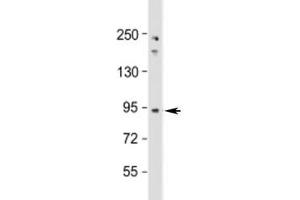 Western blot testing of human Jurkat cell lysate with NUP93 antibody at 1:1000. (NUP93 抗体  (AA 752-782))