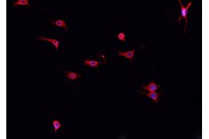 ABIN6276877 staining HepG2? (Cathepsin K 抗体  (N-Term))