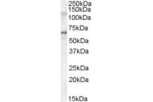 Image no. 1 for anti-Interleukin-1 Receptor-Associated Kinase 3 (IRAK3) (C-Term), (Internal Region) antibody (ABIN375025) (IRAK3 抗体  (C-Term, Internal Region))