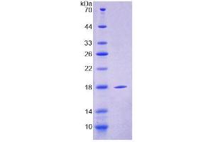 SDS-PAGE analysis of Mouse CLEC4L Protein. (DC-SIGN/CD209 蛋白)