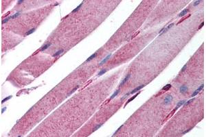 Human Skeletal Muscle (formalin-fixed, paraffin-embedded) stained with KALRN antibody ABIN213945 at 5 ug/ml followed by biotinylated goat anti-rabbit IgG secondary antibody ABIN481713, alkaline phosphatase-streptavidin and chromogen. (KALRN 抗体  (AA 1591-1605))