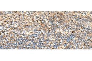 Immunohistochemistry of paraffin-embedded Human tonsil tissue using ECH1 Polyclonal Antibody at dilution of 1:50(x200) (ECH1 抗体)