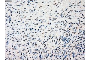 Immunohistochemical staining of paraffin-embedded lung tissue using anti-SSBmouse monoclonal antibody. (SSB 抗体)